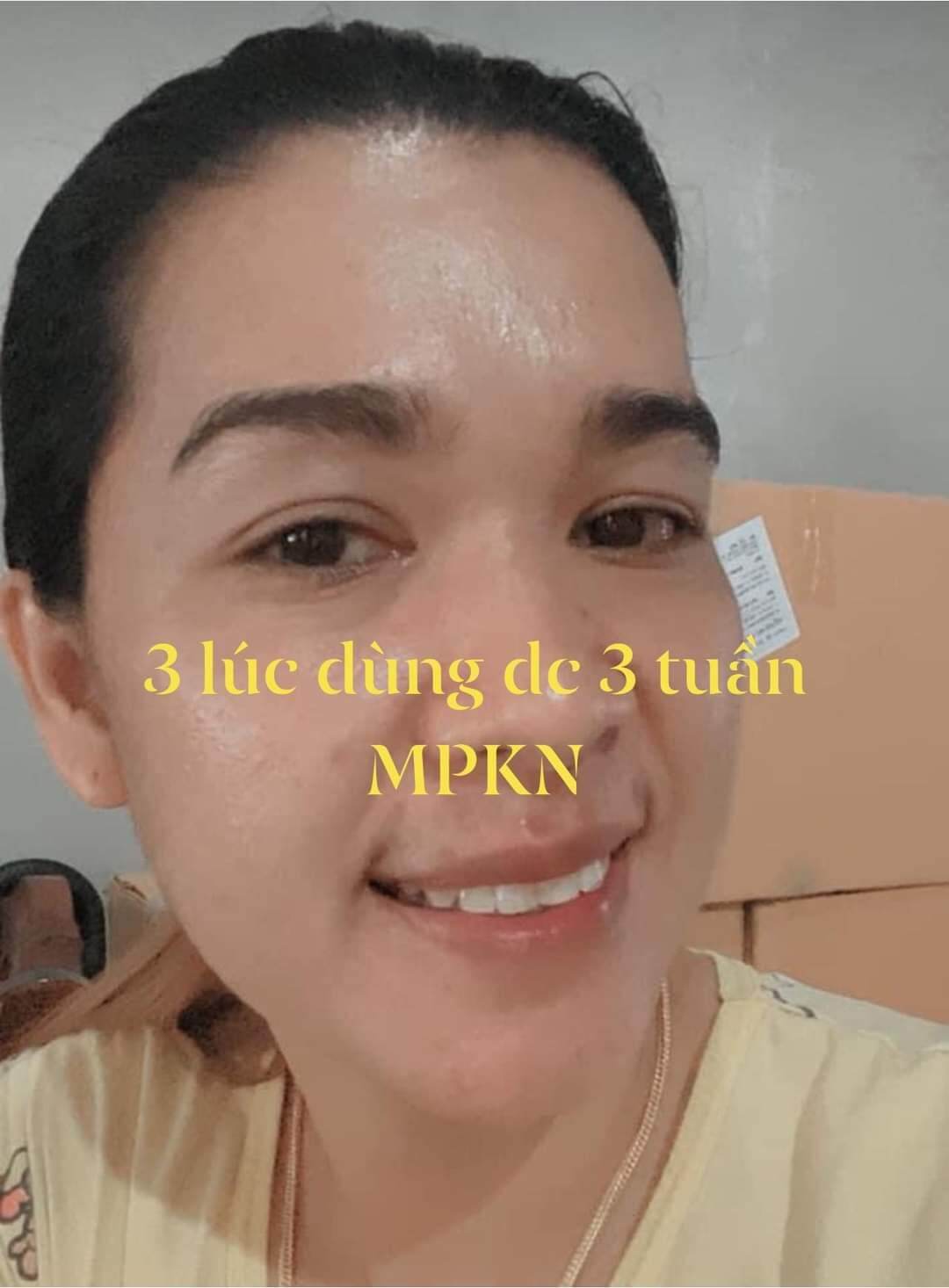 Kem face đa chức năng Kim Nhung Spa