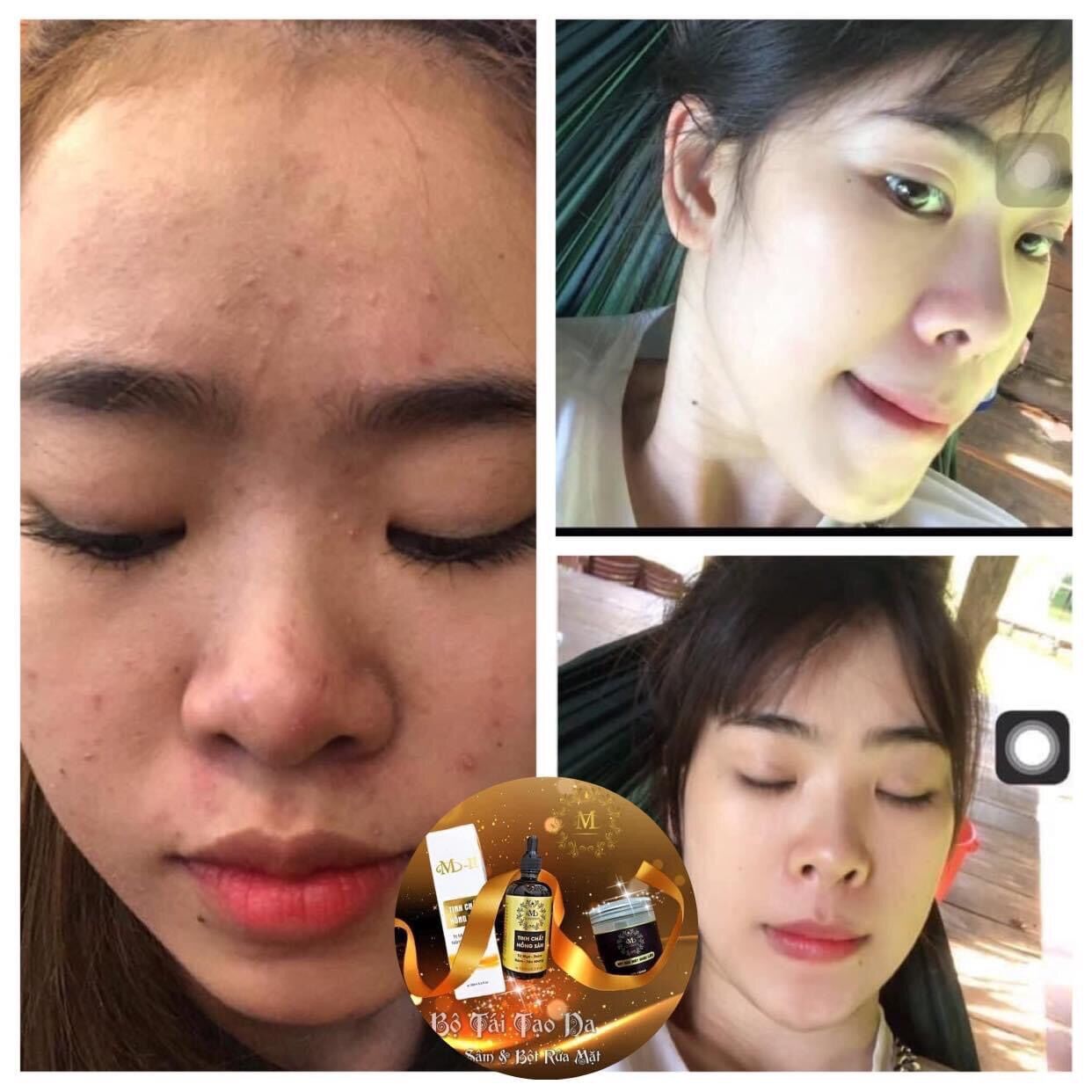 [MPVC + quà]🌸 TINH CHẤT HỒNG SÂM MCSKIN TÁI TẠO DA🌸