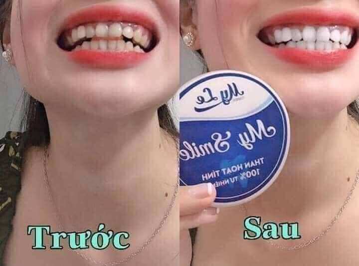 THAN HOẠT TÍNH TRẮNG RĂNG MY SMILE