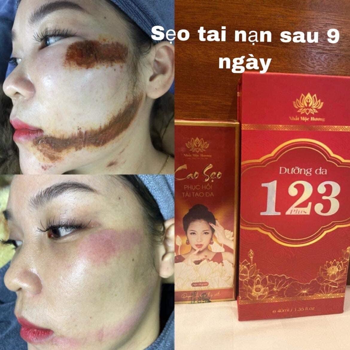 Dưỡng da 123 bách y sâm tái tạo phục hồi da mini 10ml