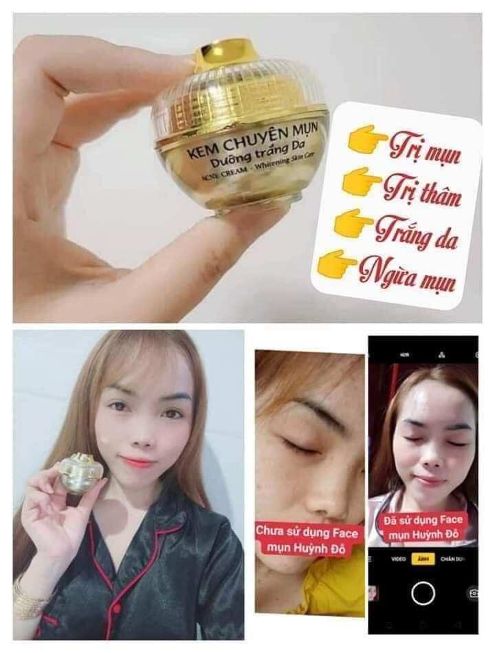 kem chuyên mụn huỳnh đỗ