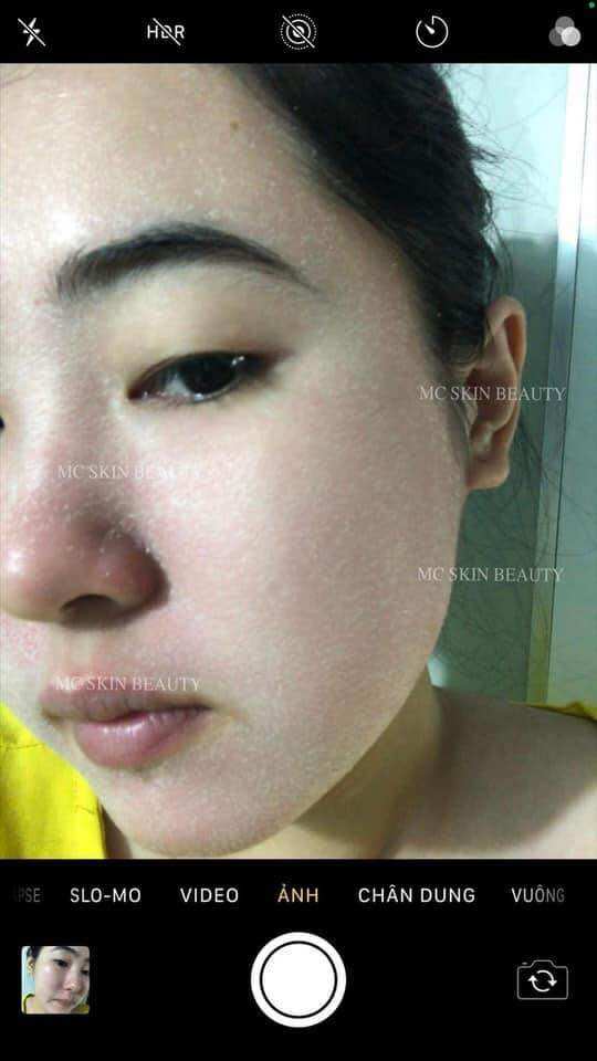 COMBO TÁI TẠO HỒNG SÂM MCSKIN