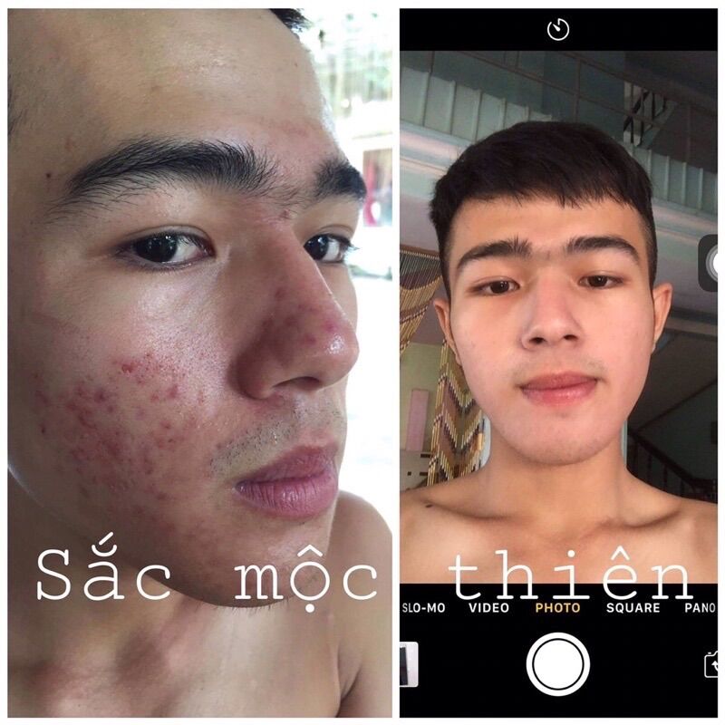 Combo 2 Chai Tinh Chất Dưỡng Da Sắc Mộc Thiên 10ml