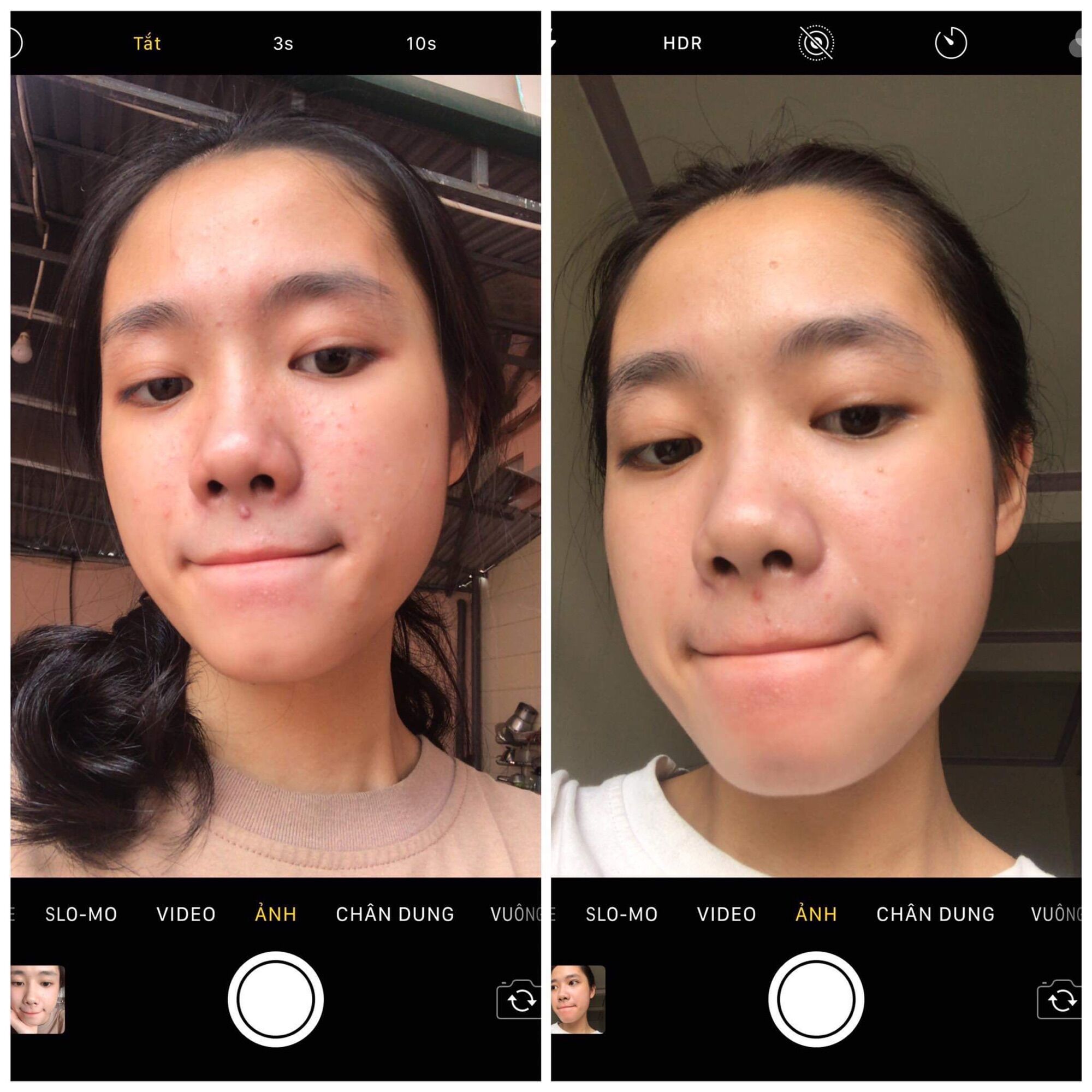 [HCM]Serum Sạch Mụn Cam Thảo