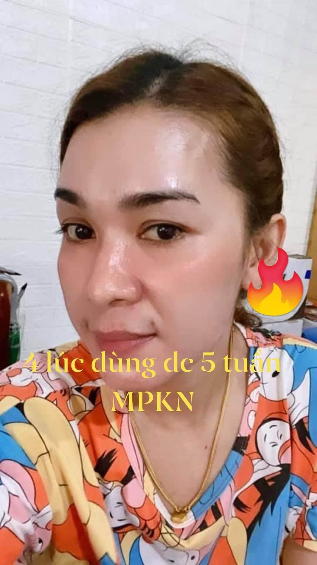 Kem face đa chức năng Kim Nhung Spa