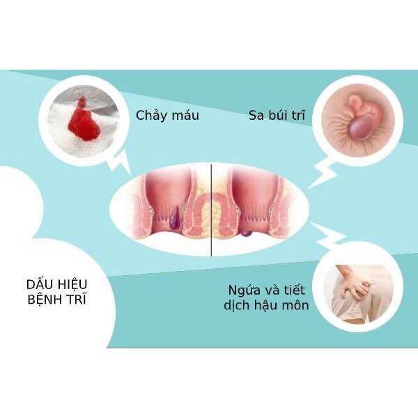 KEM BÔI CAO TRĨ SÂM ĐỎ TRẦN KIM HUYỀN