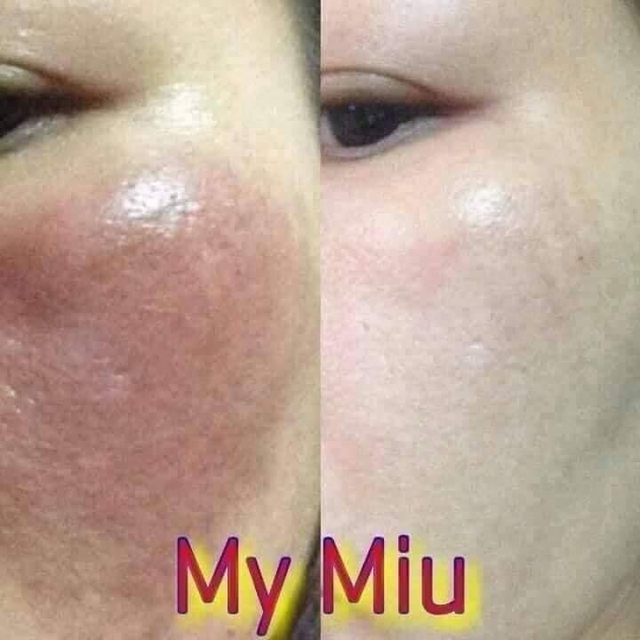 Kem Nám My Miu