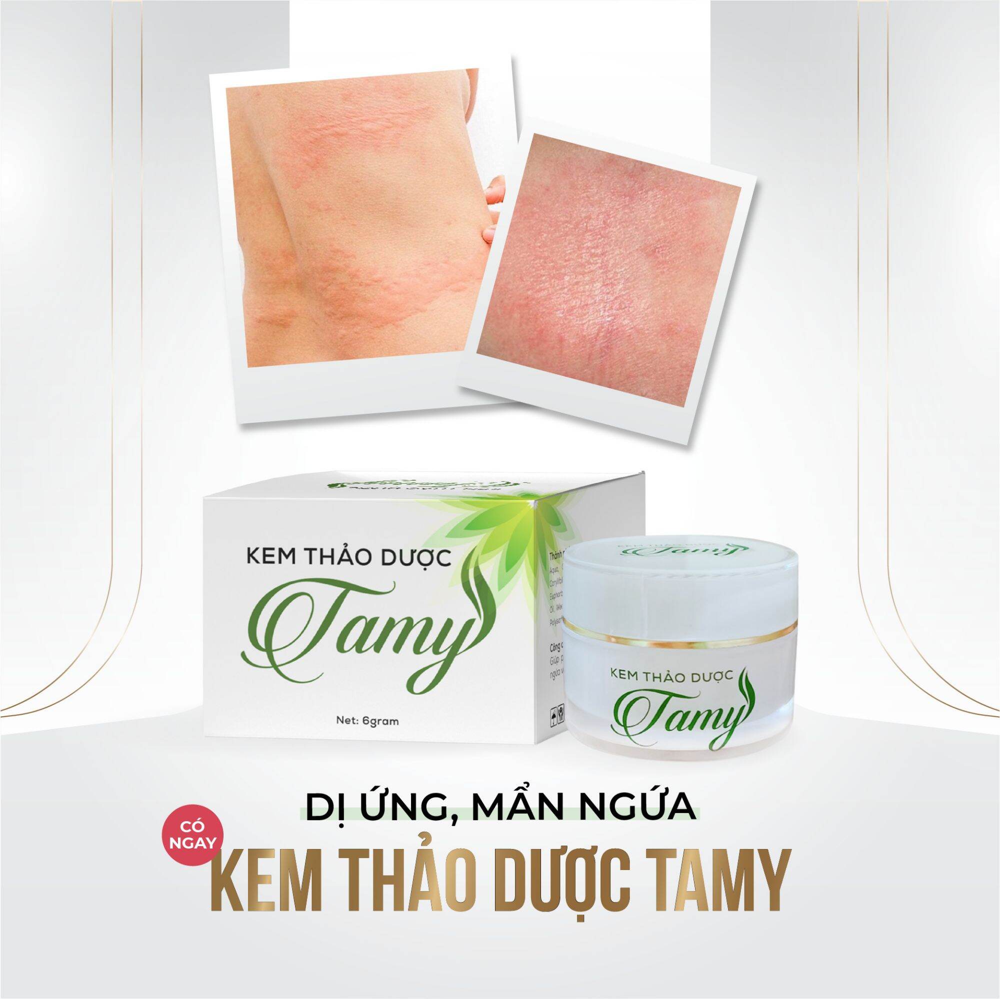 Kem thảo dược Tamy