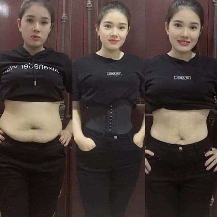 [Tặng thước đo] Đai gen nịt bụng Latex HY LẠP CHÍNH HÃNG
