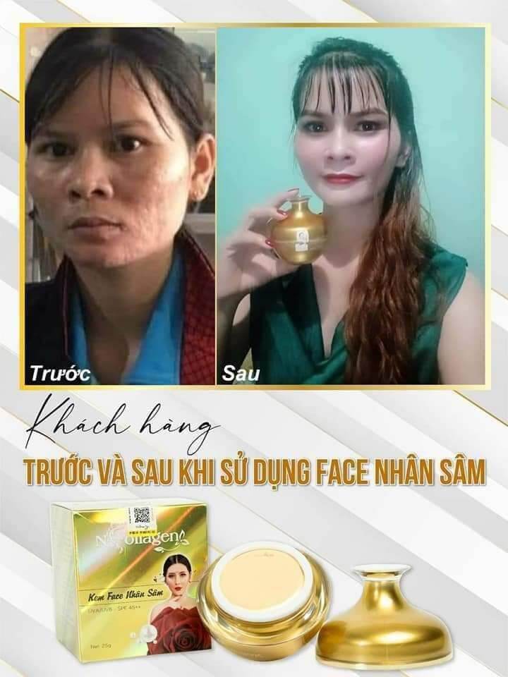 (CHÍNH HÃNG)KEM SÂM NCOLAGEN TẶNG SÉT TẨY TẾ BÀO