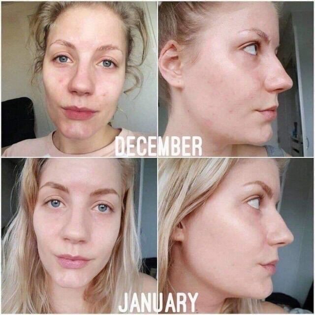 Serum Hyaluronic Acid 2% B5 The ordinary