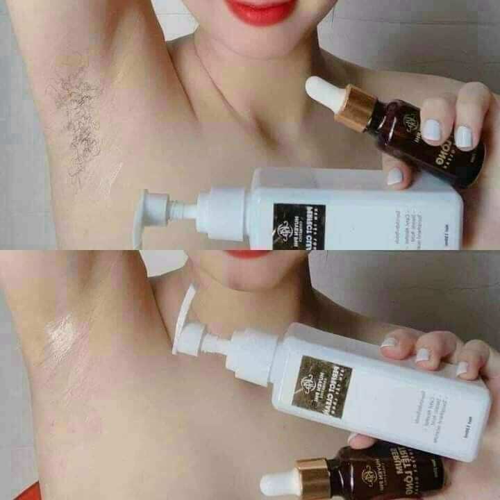 Combo tẩy lông Huyền phi.tẩy lông toàn thân