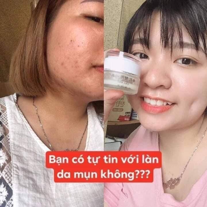 Kem Thải Độc Da Jewel Hàn Quốc 20g