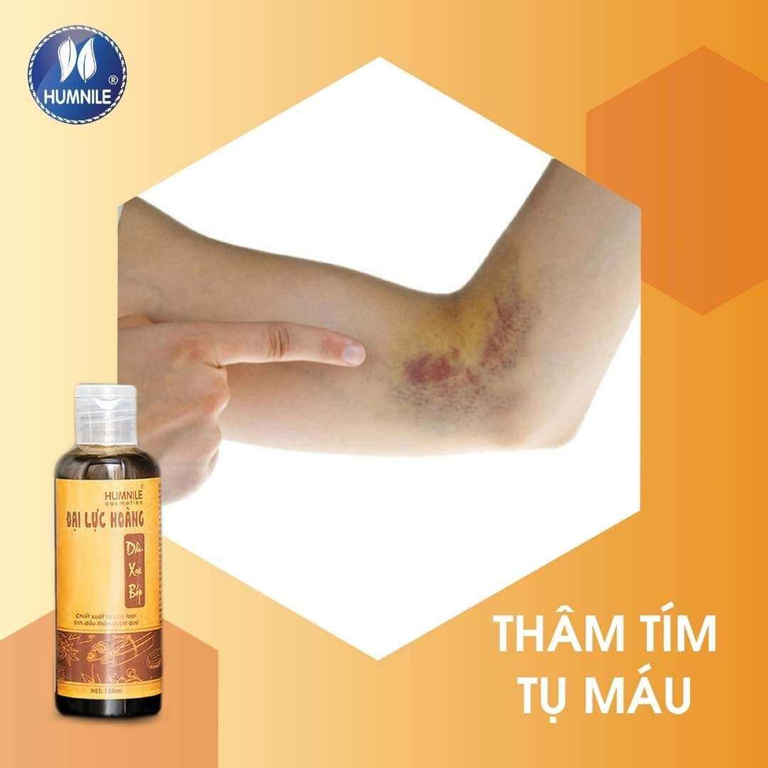 Dầu xoa bóp ĐẠI LỰC HOÀNG ( combo 5 chai )  - giải pháp hữu hiệu hỗ trợ cơ xương khớp -- ĐẠI LỰC HOÀNG