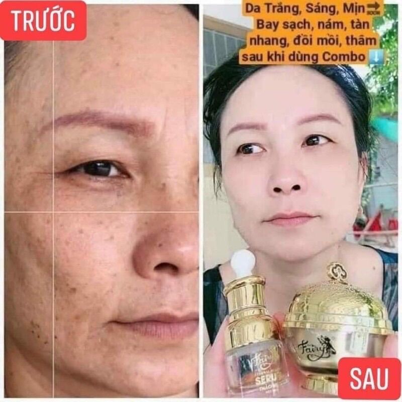 Kem Dưỡng Trắng Da Fairy Cao Cấp