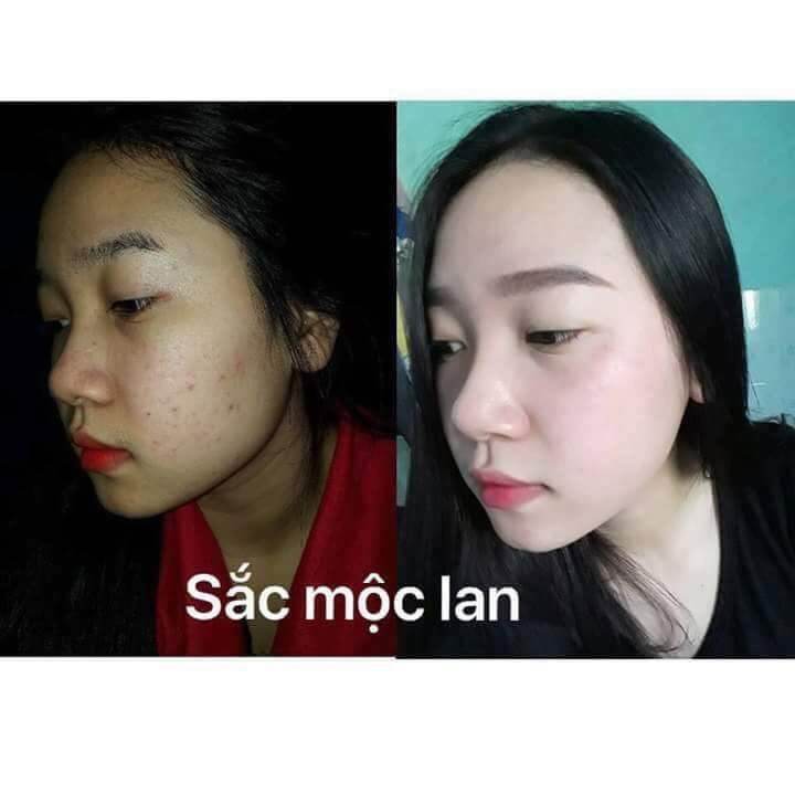[CHÍNH HÃNG] COMBO SẮC MỘC LAN - KÈM QUÀ