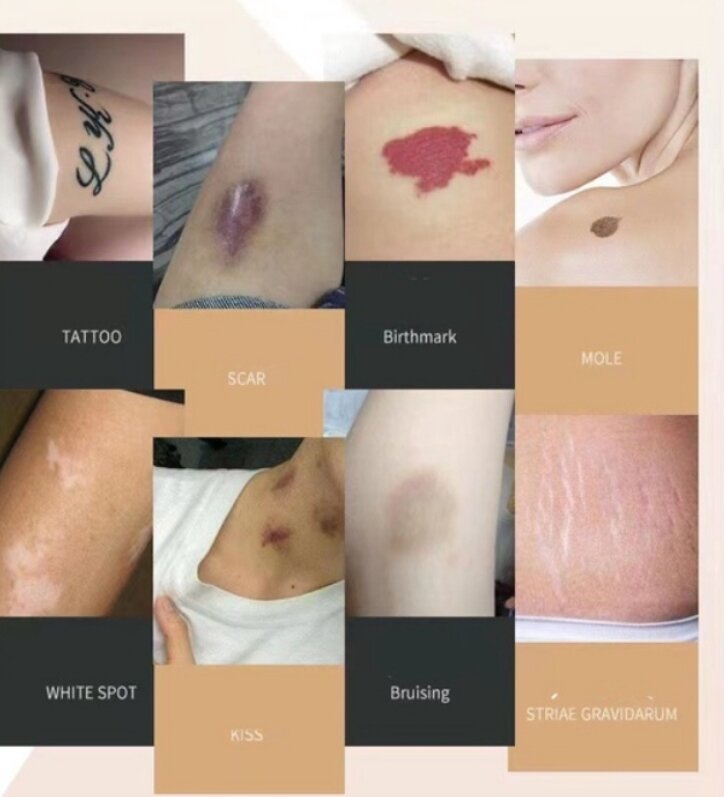 miếng dán che khuyết điểm, sẹo, chàm, hình xăm