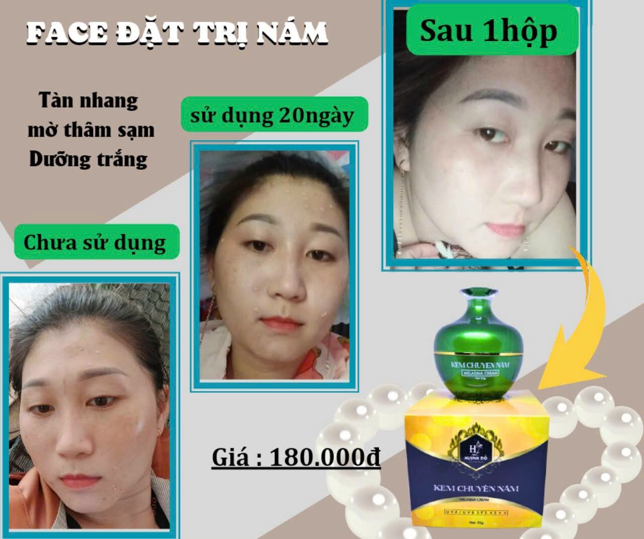 Kem nám Huỳnh Đỗ