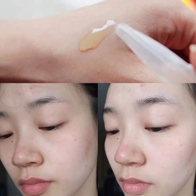 [VICHY][Có sẵn, bill Canada] Tinh chất Vichy Liftactiv Ampoules Peptide-C