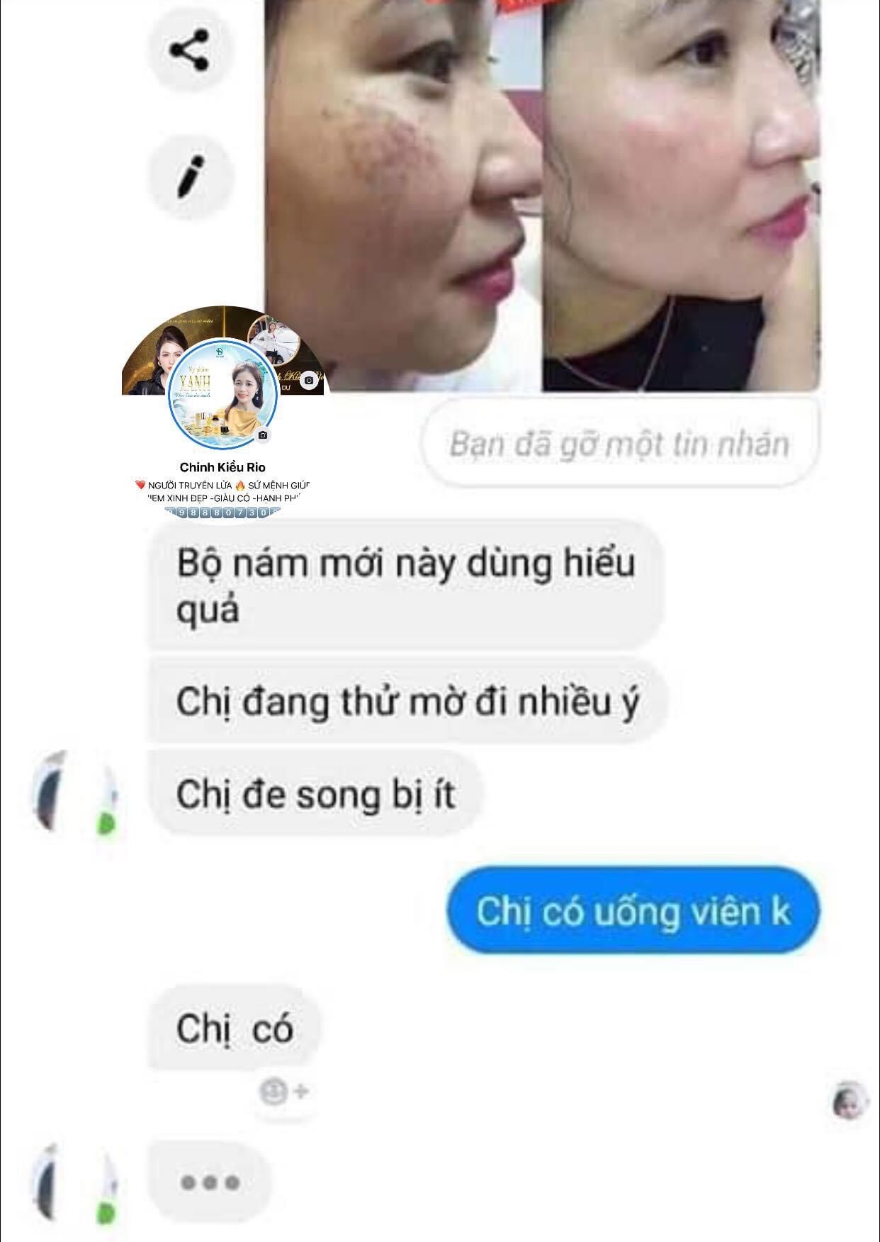 VUA NÁM NGHỆ COLLAGEN BAN NGÀY