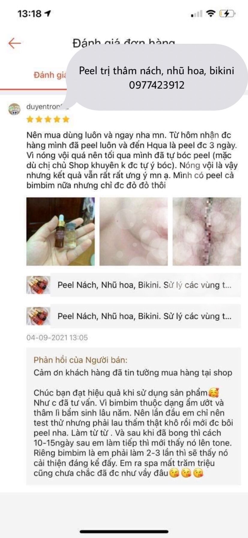 Peel Làm Hồng Nách, Nhũ Hoa, BiKiNi
