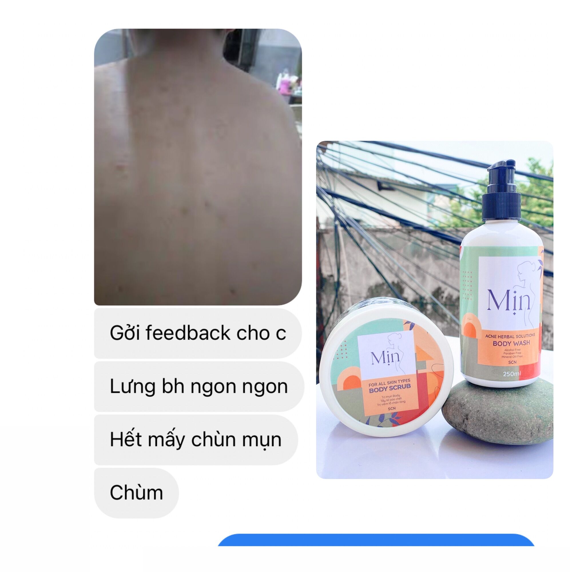 Hũ Muối Dẻo Scrub Mịn - Mụn, Viêm Nang, TTBC