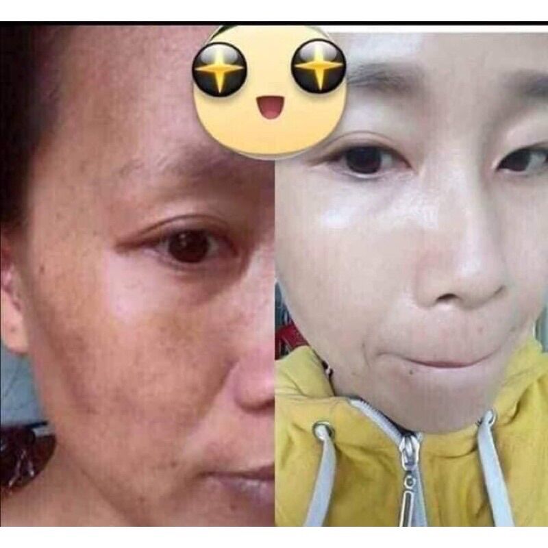 Sữa rửa mặt Hoàng cung hồng trắng da sạch nhờn