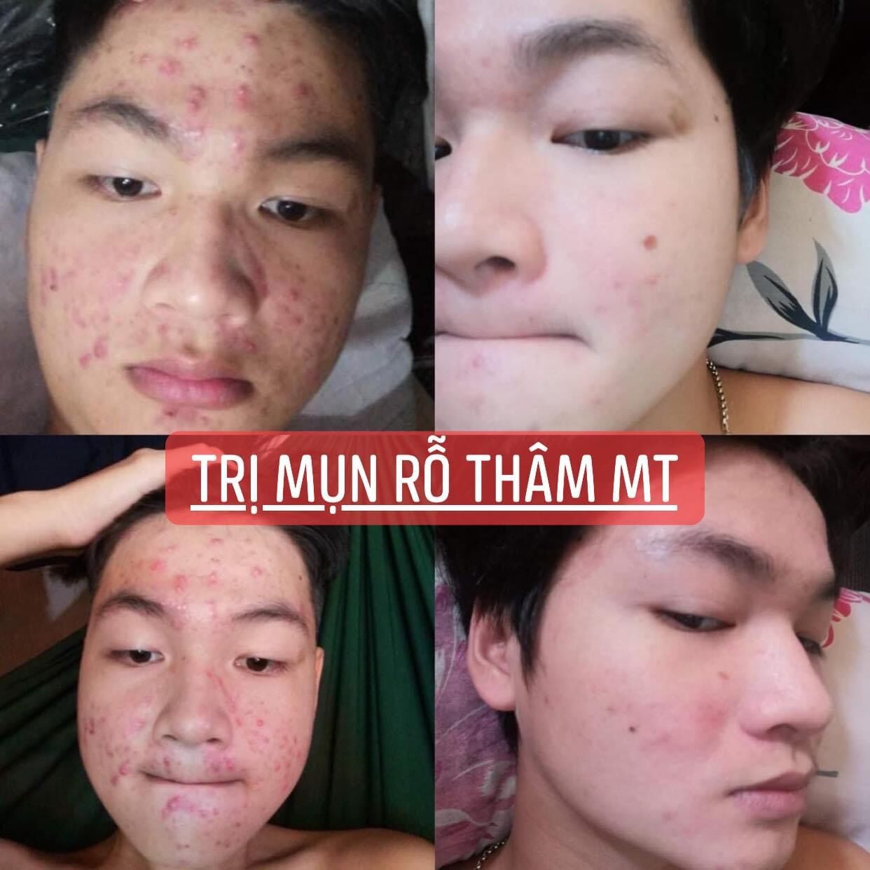 Thảo dược nhân sâm tái tạo(giá sỉ tại xưởng từ 450ml )handmade(loại chuẩn)