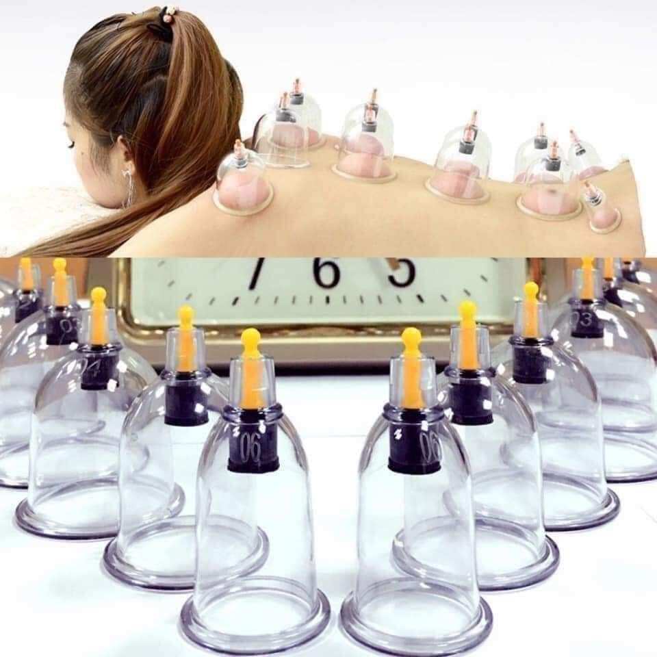 bộ giác hơi 24