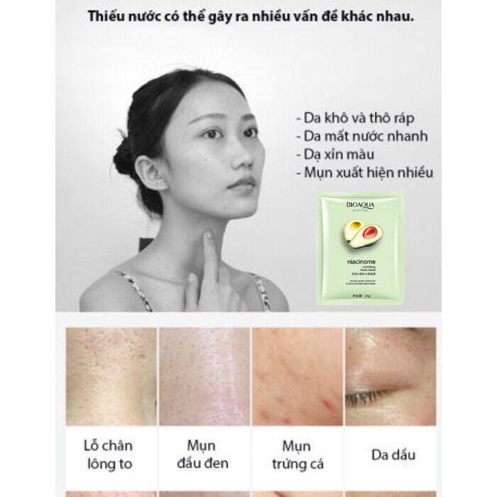 Mặt nạ bơ Bioaqua cấp ẩm, sáng da,giảm thâm mụn