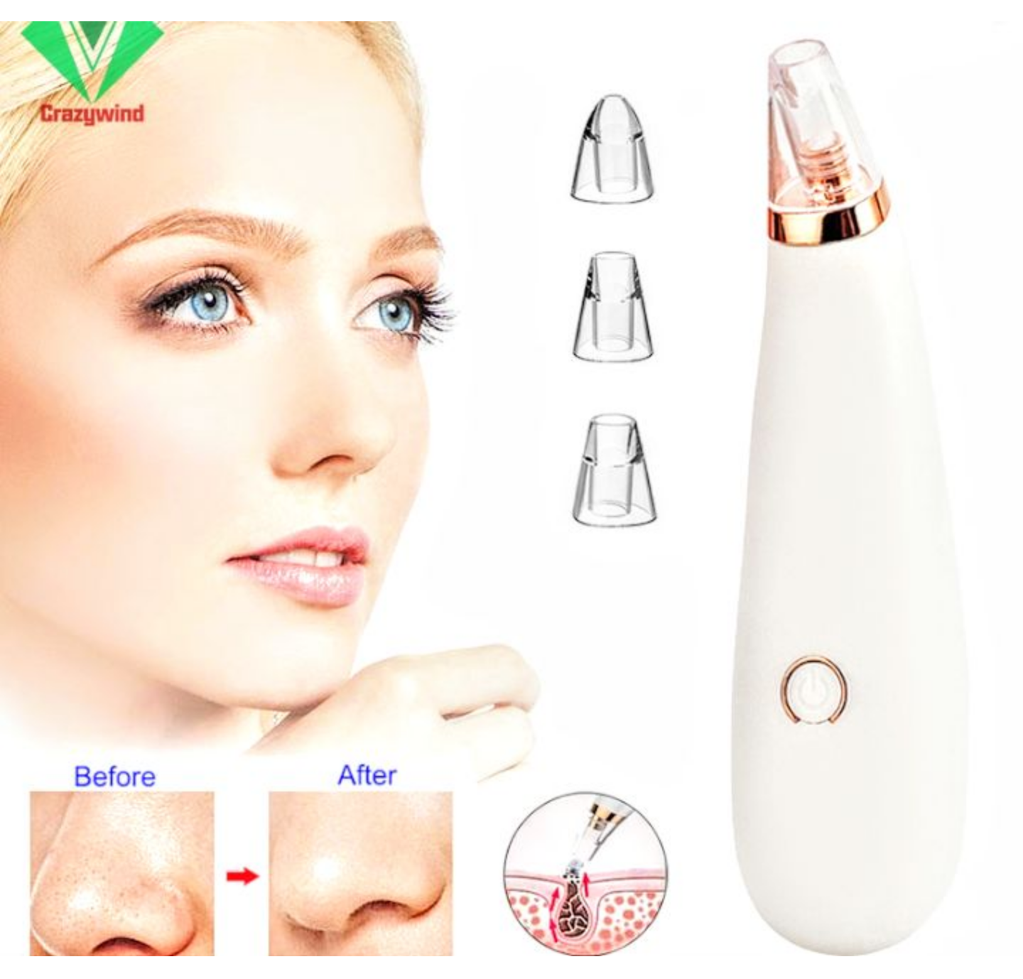 Máy hút mụn đầu đen mụn trứng cá chuyên sâu cam kết hàng loại tốt