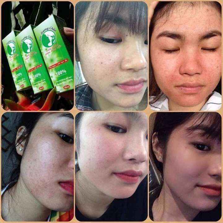 Dược Phẩm Đông Y Mộc Dương Châu 30ml