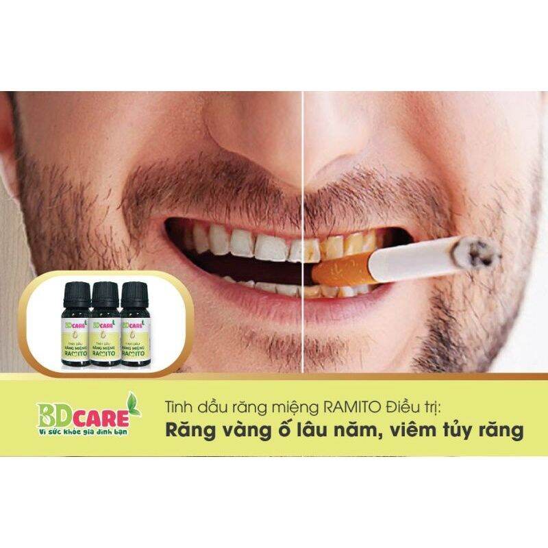 Tinh dầu răng miệng Ramito -10ml