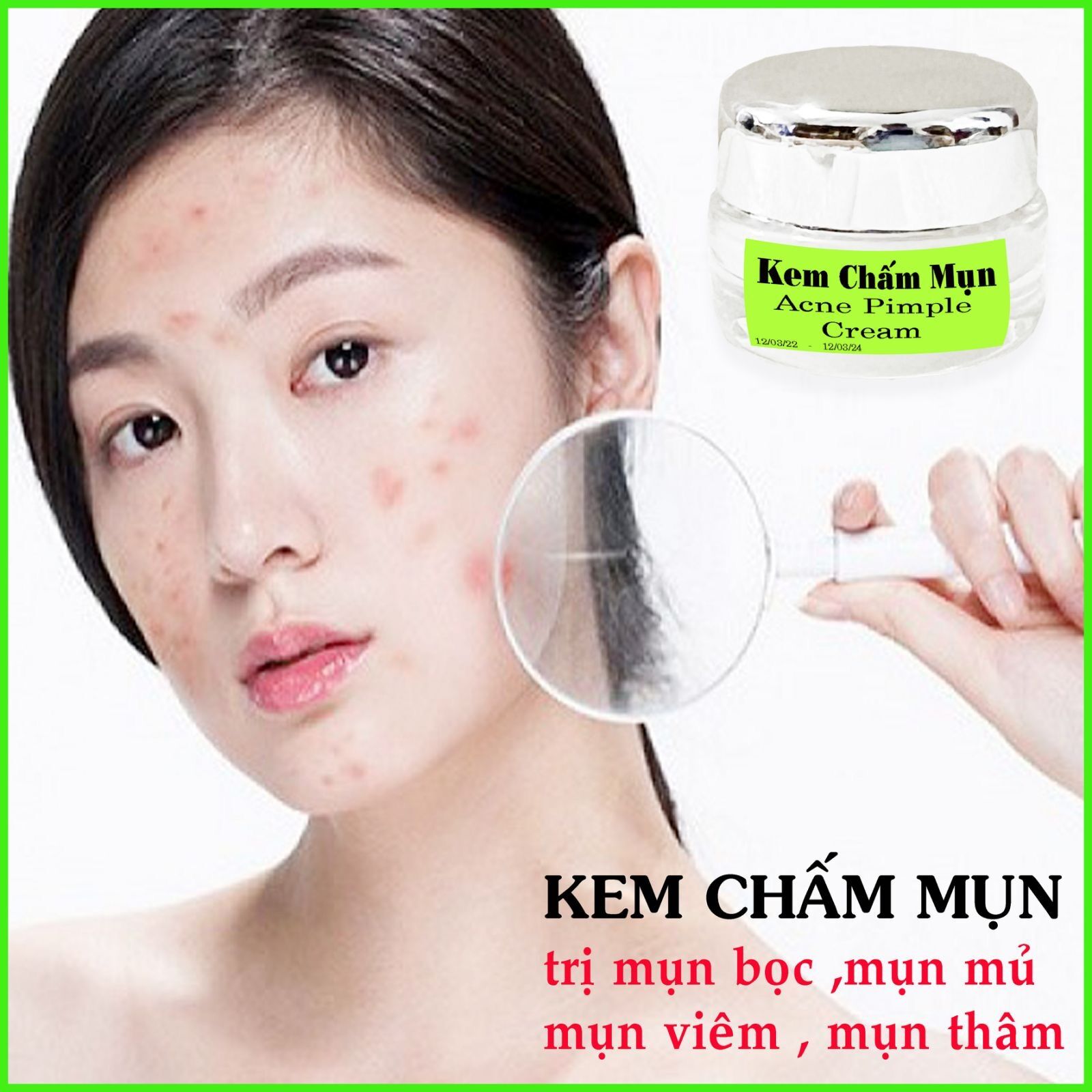 Kem Chấm Mụn Xẹp Nhanh Mụn Bọc,Mụn Viêm
