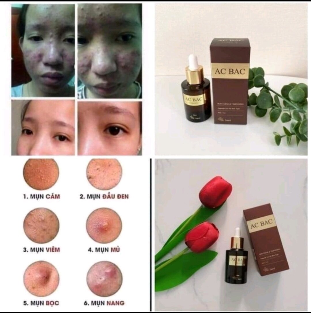 Tinh chất giảm mụn Ac Bac Serum Hàn Quốc 30ml