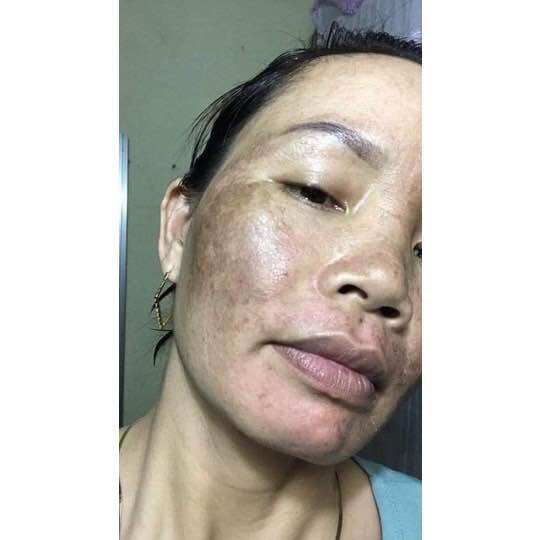 THẢO MỘC NÁM DA TRẦN KIM HUYỀN