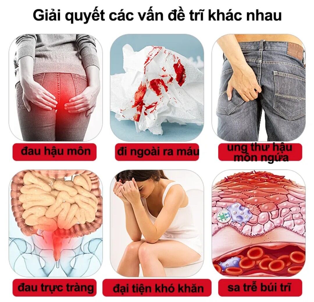 Kem bôi trĩ , hậu môn, kéo búi Trĩ.