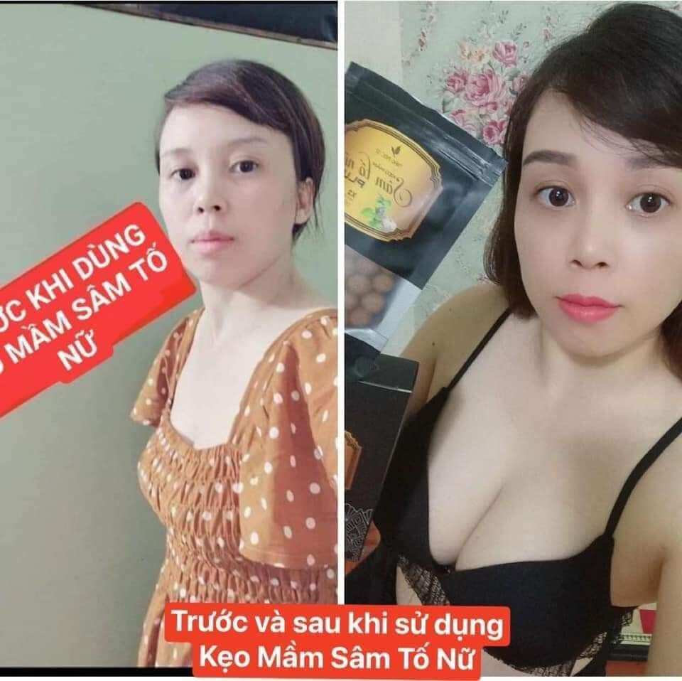 Kẹo mầm sâm tố nữ plus x2 thảo mộc 37(mua 4 hộp tặng 1 hộp nữa là 5 tặng kèm dây đo )