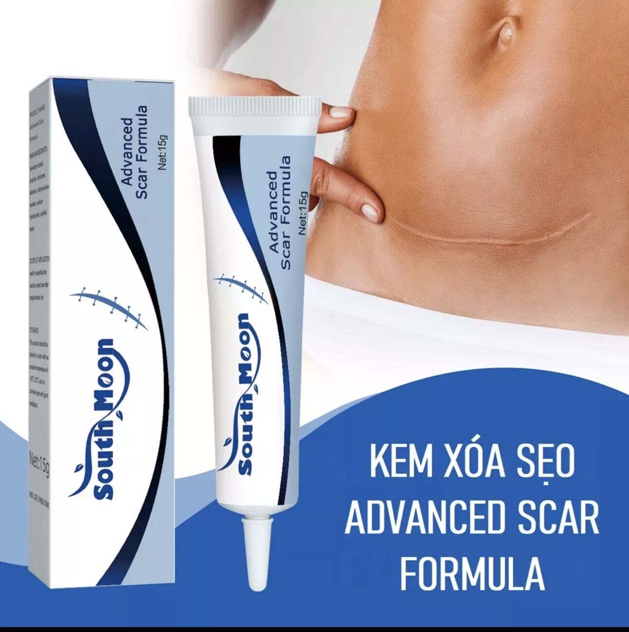 Kem giảm sẹo 15g south moon giúp chăm sóc da hiệu quả