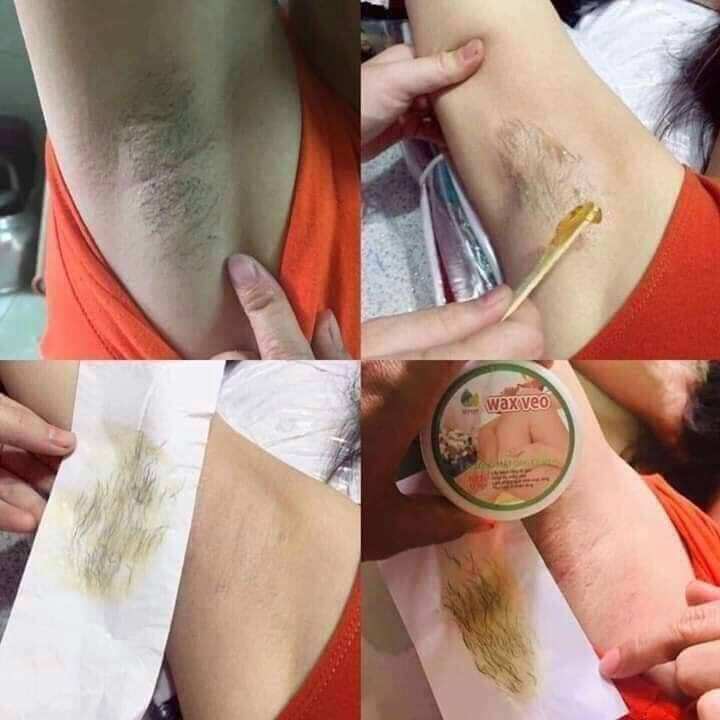 [ Tặng kèm que và giấy] Wax lông veo, Triệt lông vĩnh viễn, Triệt lông tay chân nách và bikini