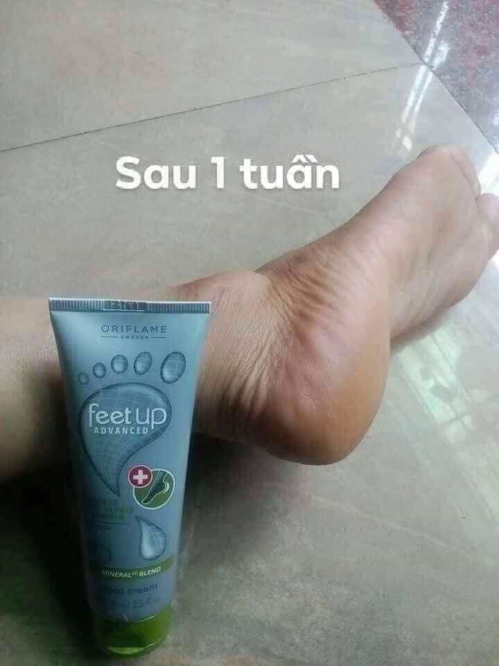Kem Dưỡng ẩm  nứt gót da chân oriflame