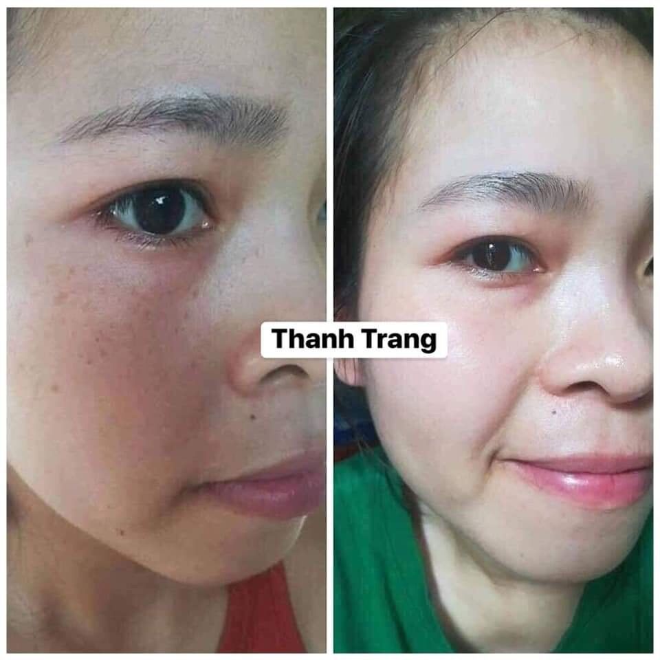 Tái Tạo Thanh Trang( Loại Cấp Tốc)