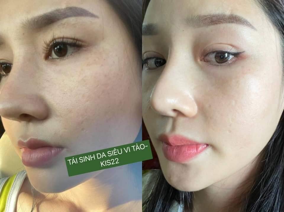 Combo Tái Sinh Da Green Vita (1 Serum và 1 Bột Rửa Mặt)