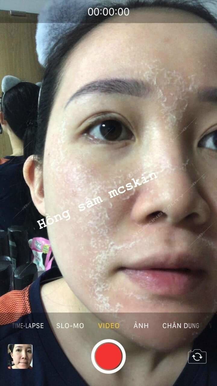 (1 chai)Tinh chất Tái tạo da hồng sâm MC_SKIN (chínhhãng).