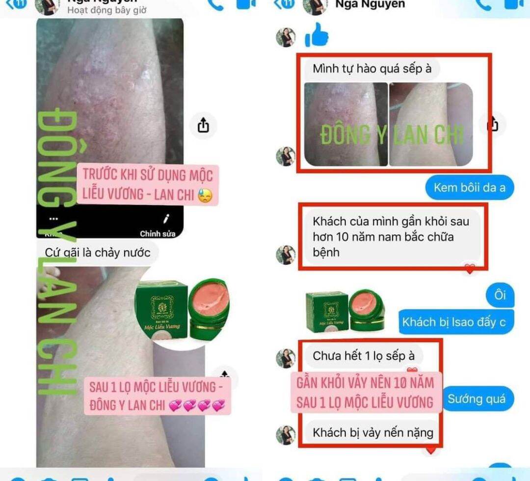 Kem Da Liễu Gia Truyền