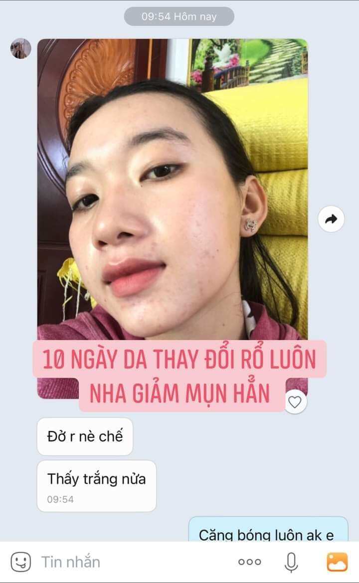 kem mặt ngọc Oanh