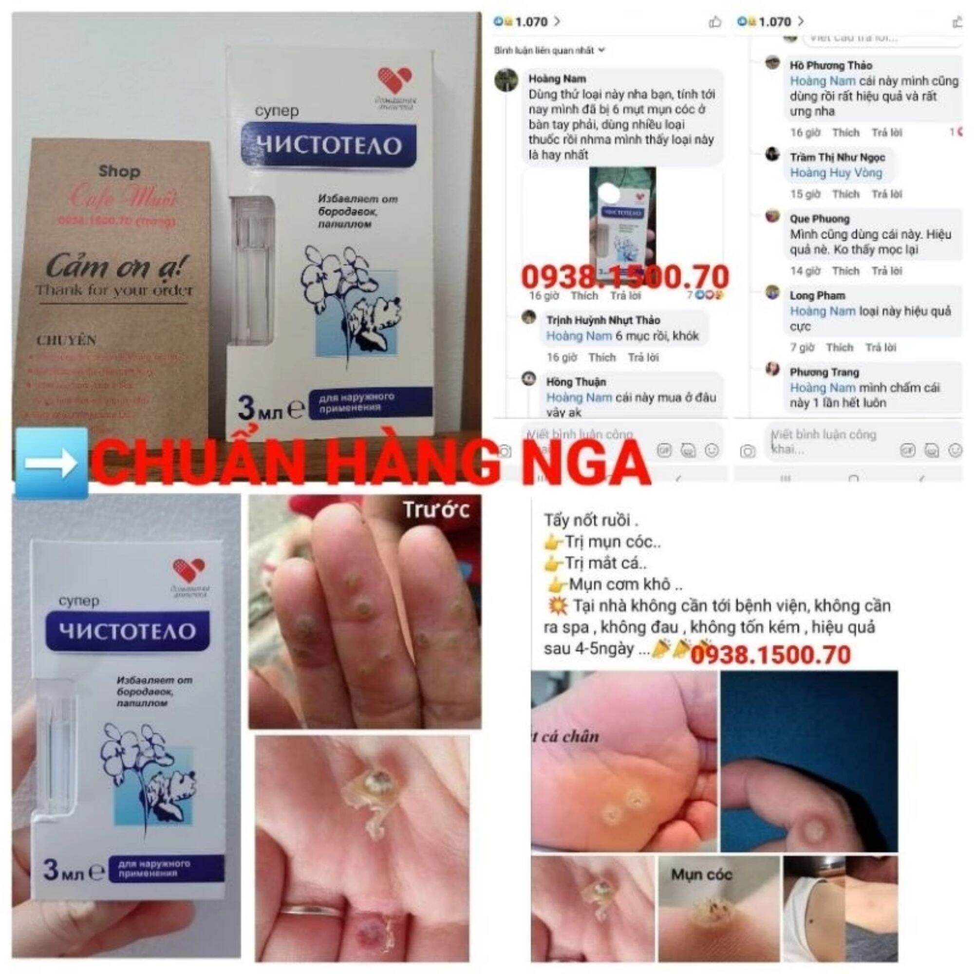 GEL CHẤM MỤC CÓC Dvelinil CỦA NGA ❌ chuẩn hàng loại 1