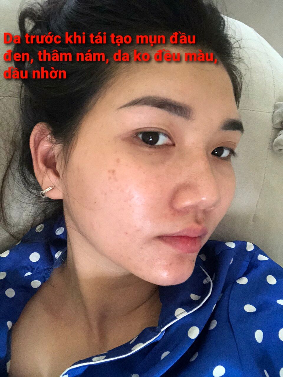 HỒNG SÂM TÁI TẠO