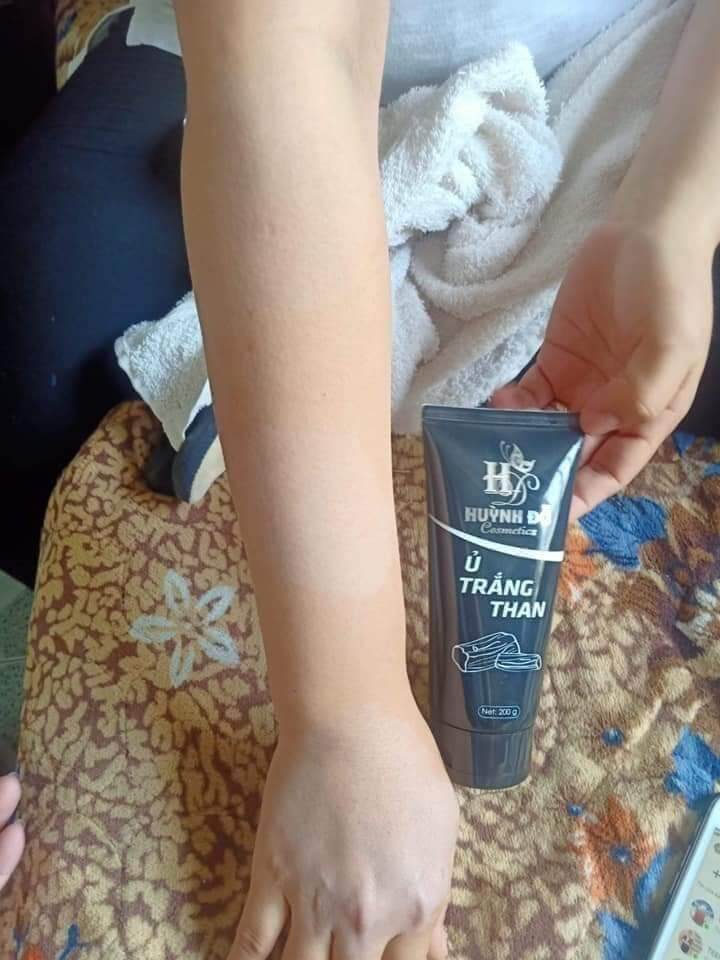 Ủ TRẮNG THAN HUỲNH ĐỔ