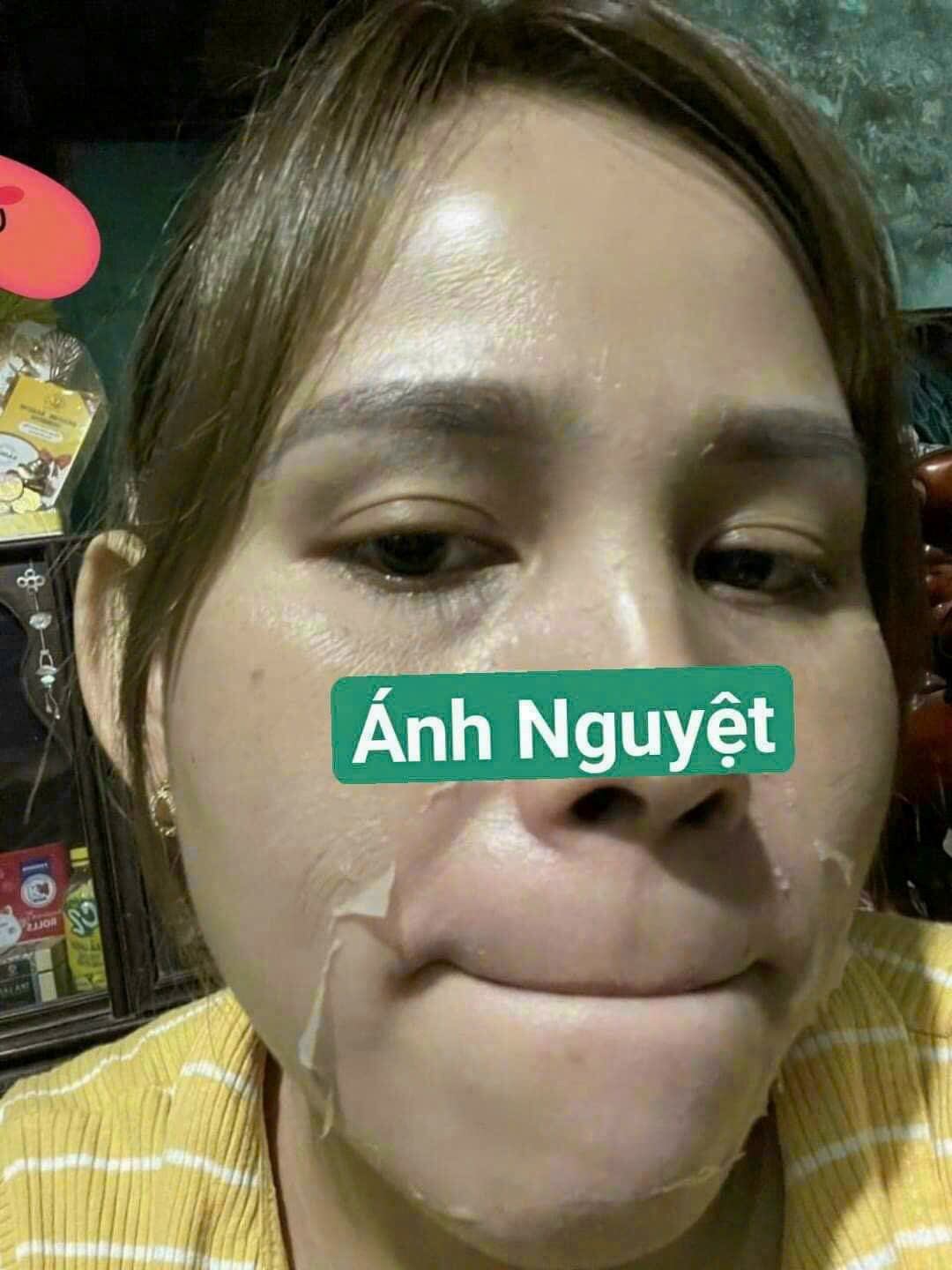 kem tái tạo MH 200k